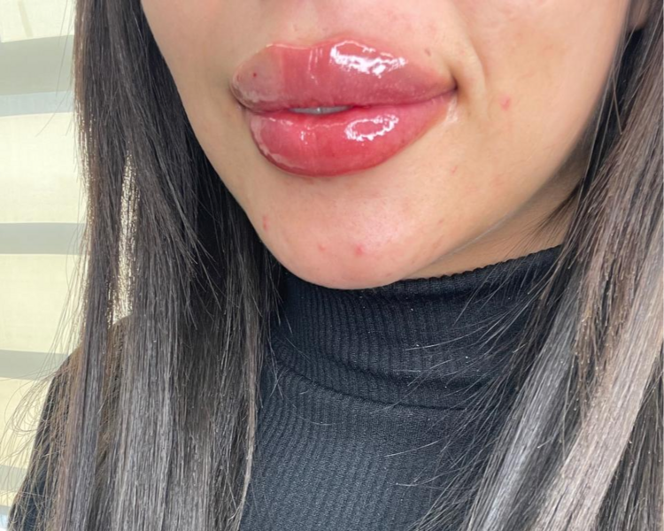 Labios rusos combinación Pink Glow
