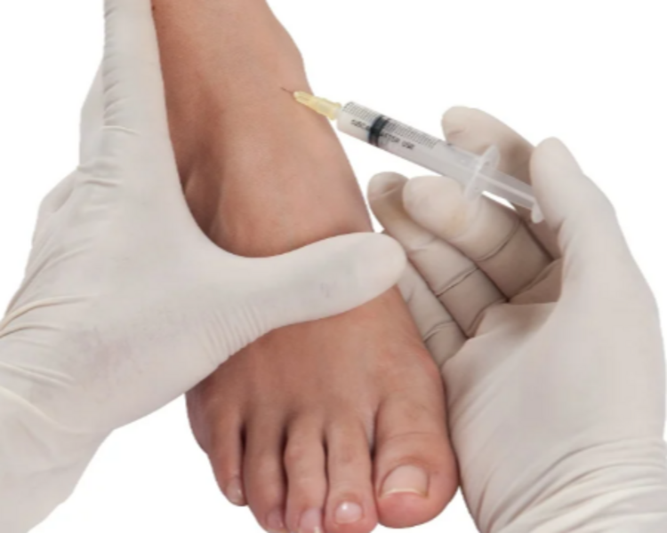 Infiltaciones Unilateral Tobillos  / Unilateral Ankle Infiltrations