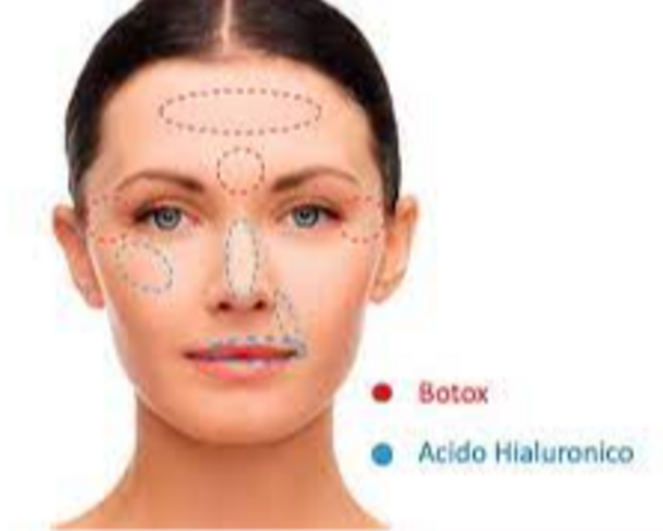 💫 Full Face / Armonización Facial