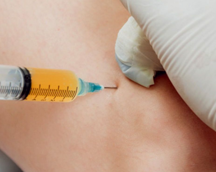 Infiltraciones de ambas Articulaciones con Acido hialuronico