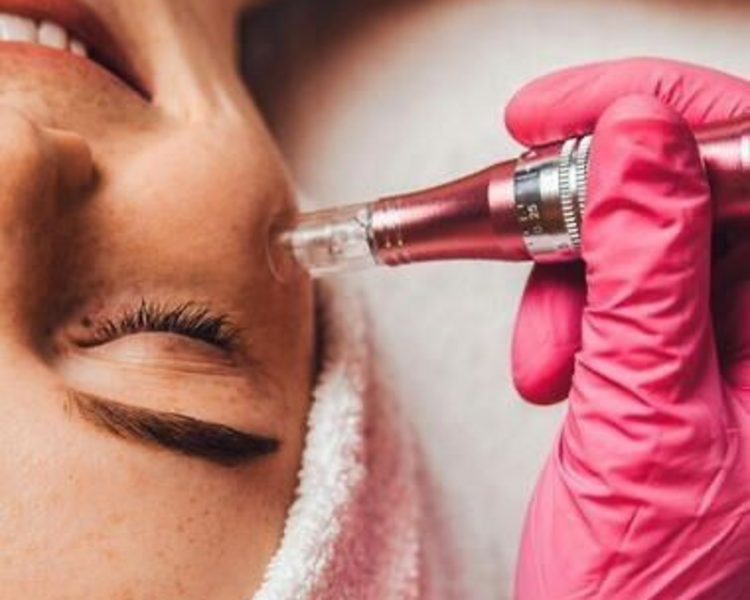 MICRONEEDLING (DERMAPEN)