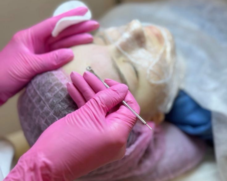 LIMPIEZA Y RENOVACIÓN FACIAL PROFUNDA + PEELING VERANO