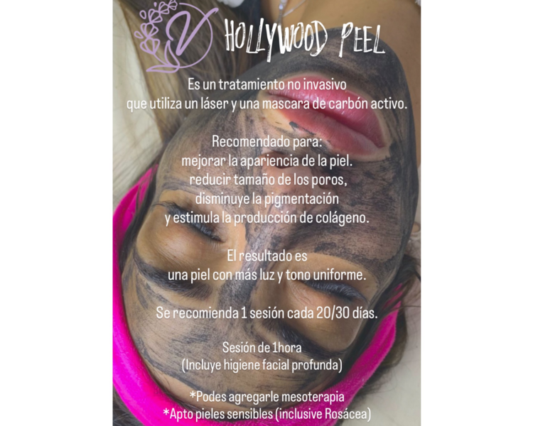 Hollywood Peel