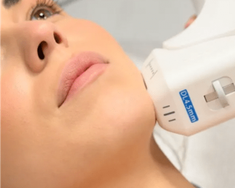 Pack "Rejuvenecimiento profundo": 1 HIFU facial (efecto lifting) + 1 Pink Glow + 3 radiofrecuencias + 1 Limpieza facial profunda