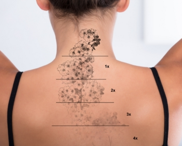 Evaluación tatuaje - Presencial