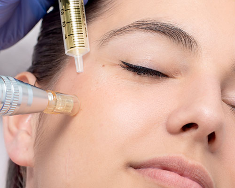 Plasma + Limpieza Facial (promo)