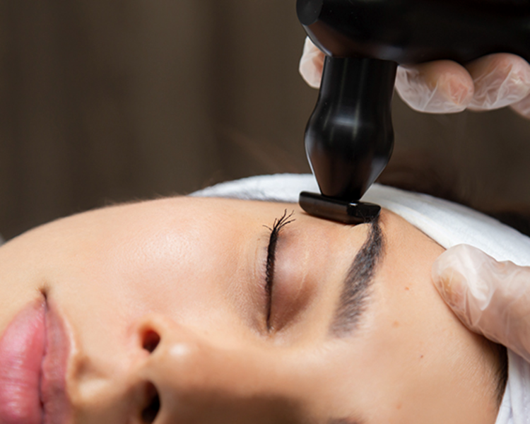 Tensamax facial + Yesoterapia  (promo)