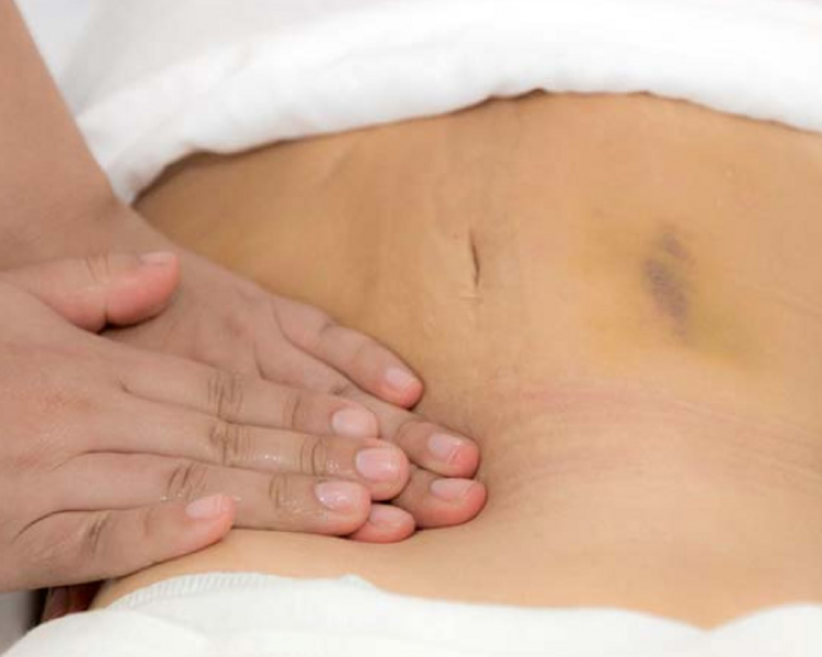 Postoperatorio Localizado