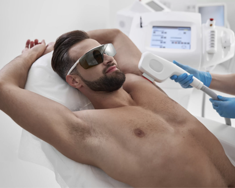 Depilacion - Axilas (30% de descuento)