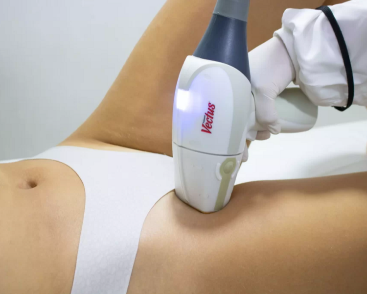 Depilación Laser Bikini Completo (incluye linea entrepierna)