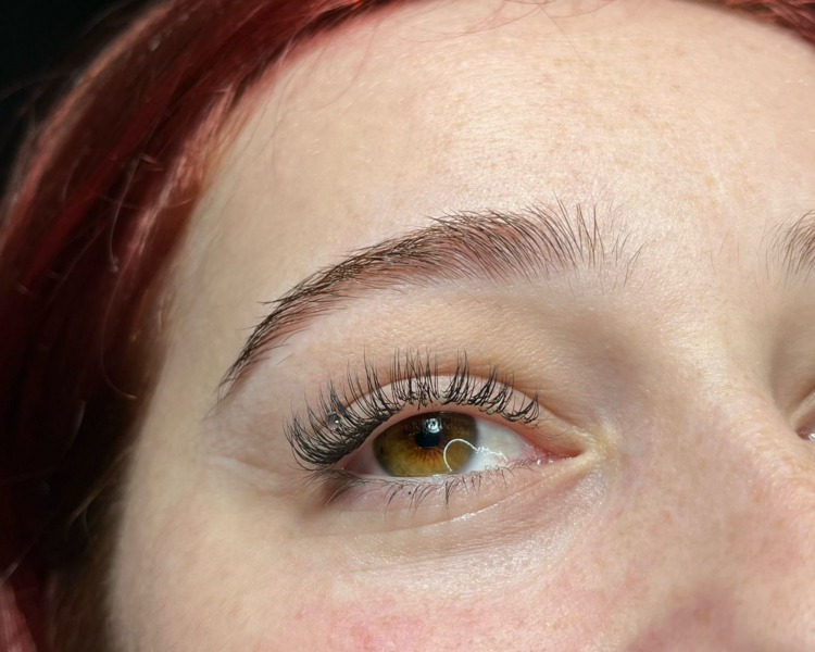 Extensiones clasicas