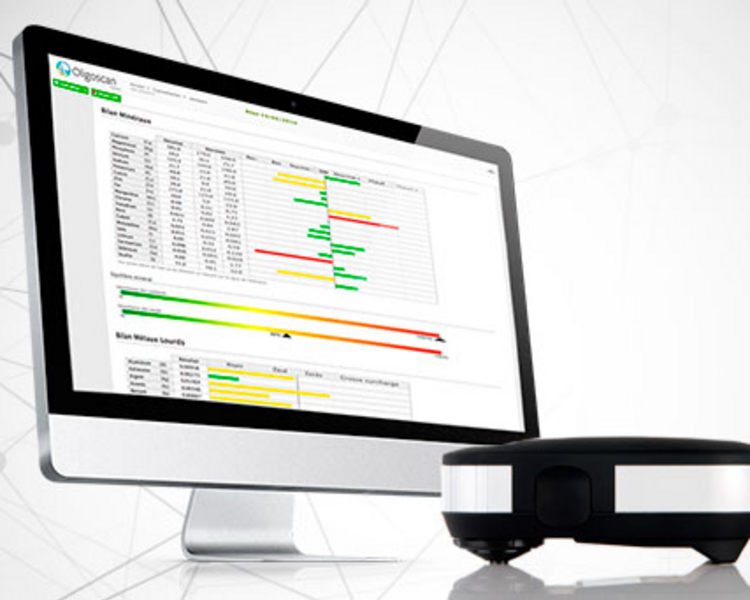 Estudio Oligoscan® [Test de Minerales y Metales Pesados]