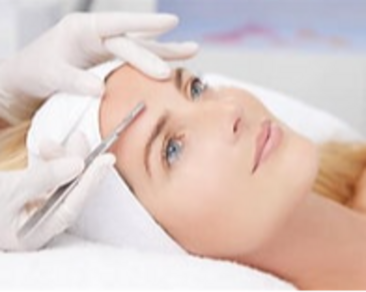 Dermaplaning con ácidos