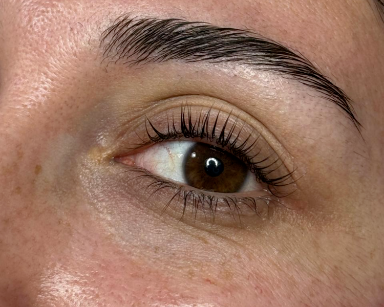 Laminado de Cejas + Botox