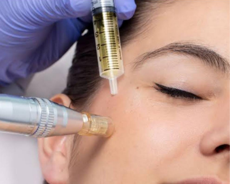 Dermapen- Plasma