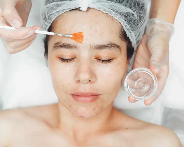 Antiacne