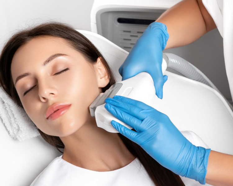 Depilacion IPL- Rostro