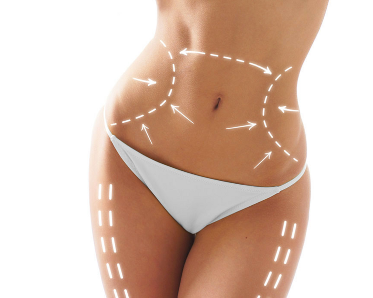 Valoración de control