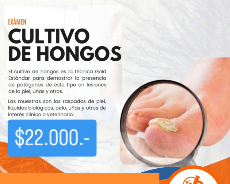 Toma de muestra cultivo 