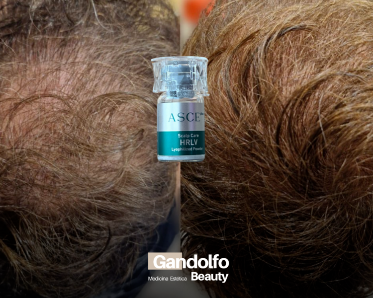 Exosomas Asce capilares