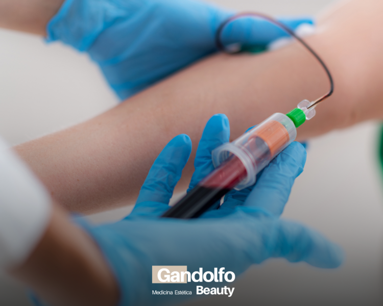 Plasma rico en plaquetas facial cuello y escote