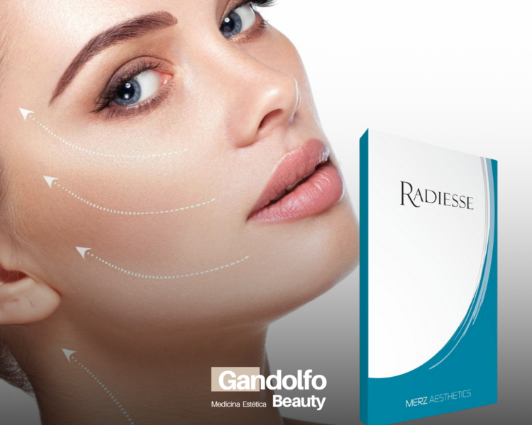 Radiesse