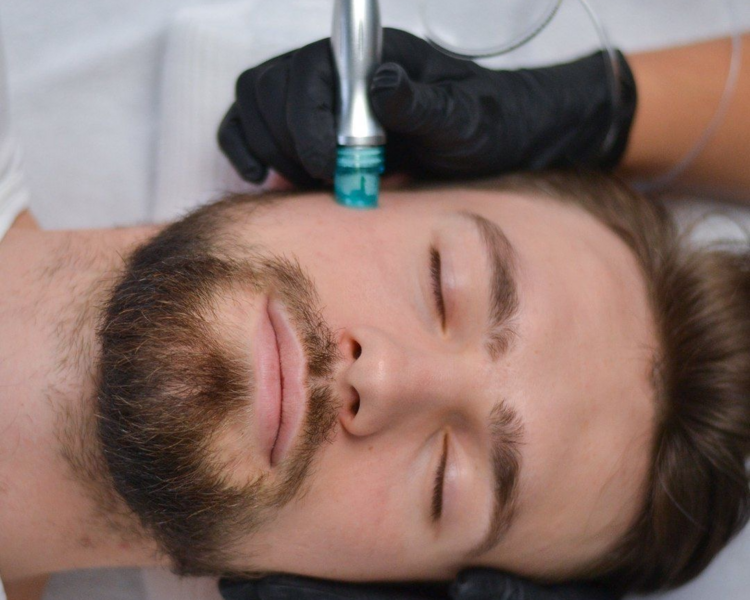 Limpieza facial masculina