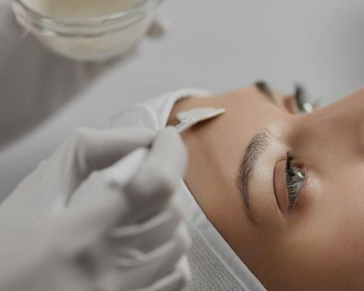 Peeling facial 3 sesiones