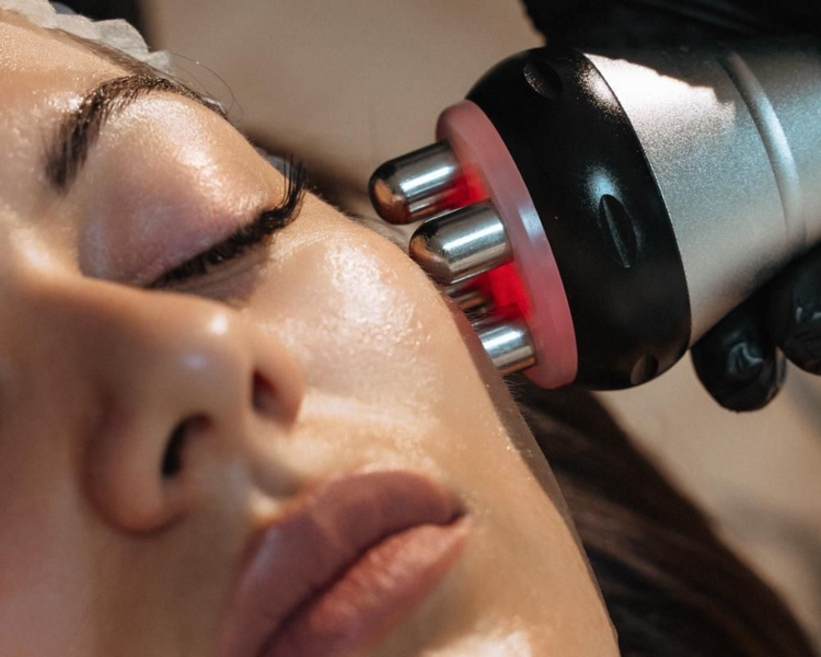 Radiofrecuencia Facial