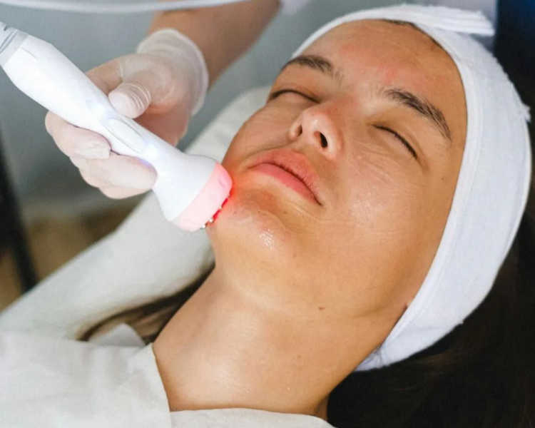 3 Radiofrecuencia facial