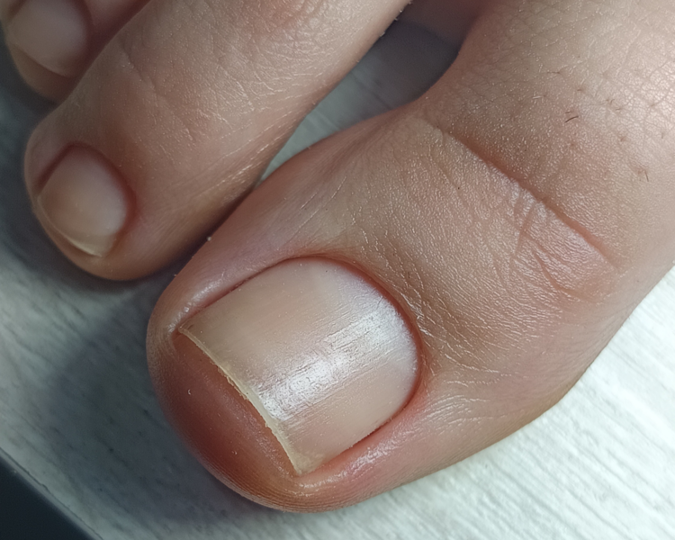 Pedicura Sin Esmaltado