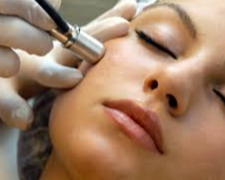 Microdermoabrasión peeling mecánico 