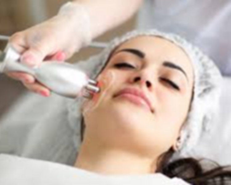 radiofrecuencia facial 