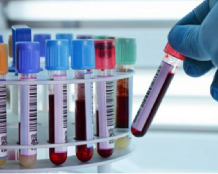 CHECK UP BASICO 1 (BHC,QS 7 ELE EGO)