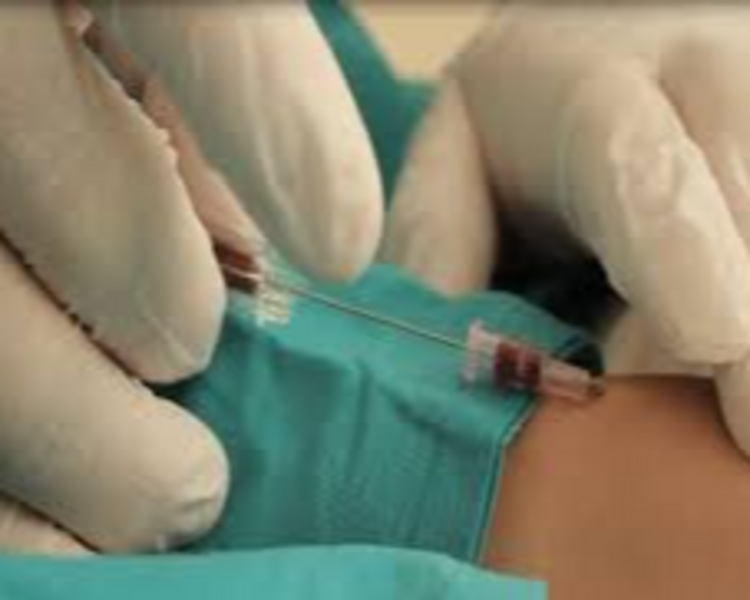 CANALIZACION DE VIA PERIFERICA