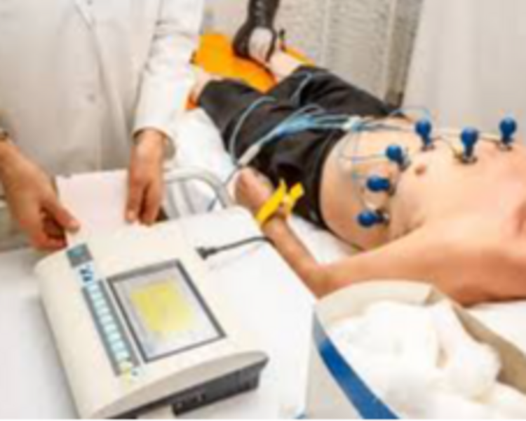 ELECTROCARDIOGRAMA 12 DERIVACIONES