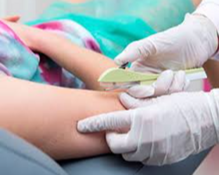 COLOCACION DE IMPLANTE SUBDERMICO