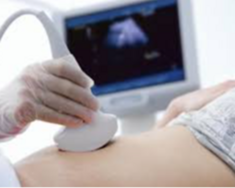 ULTRASONIDO ABDOMEN TOTAL