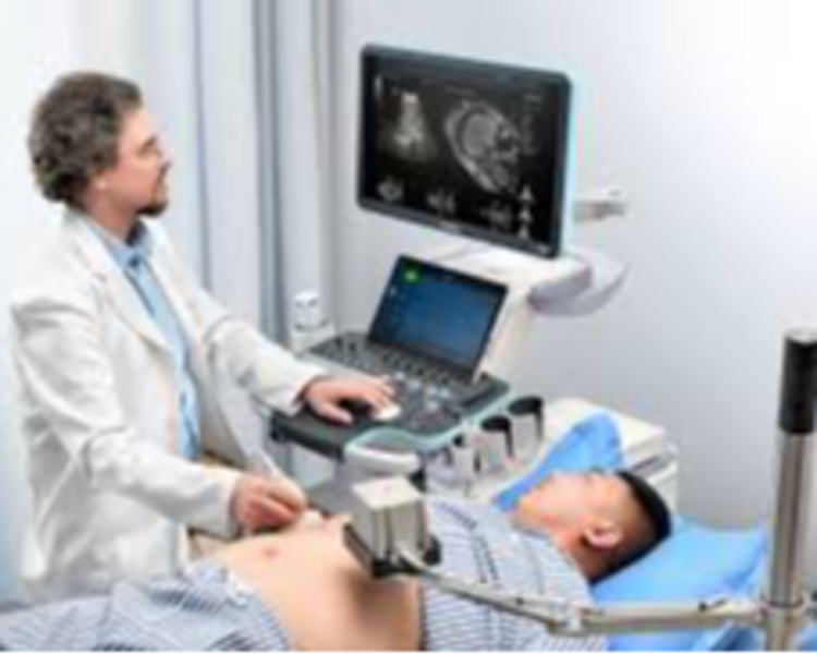 ULTRASONIDO HIGADO Y VIAS BILIARES