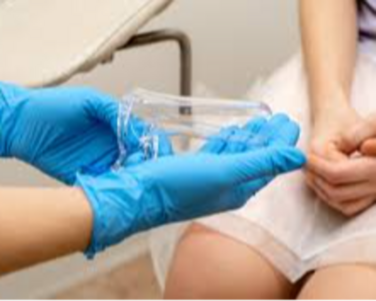 Citologia Cervical ( PAPANICOLAOU)