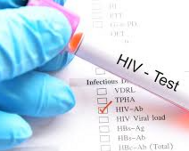 LABORATORIO ETS (VIH, V.D.R.L)