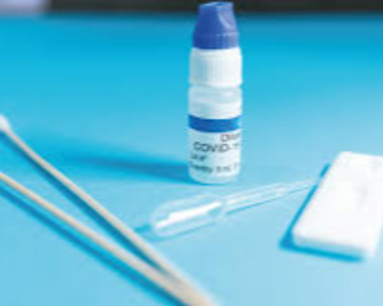 TOMA DE PRUEBA INFLUENZA/COVID19