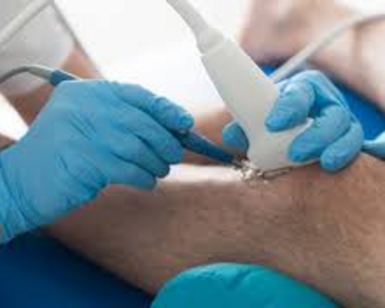 ULTRASONIDO TEJIDOS BLANDOS