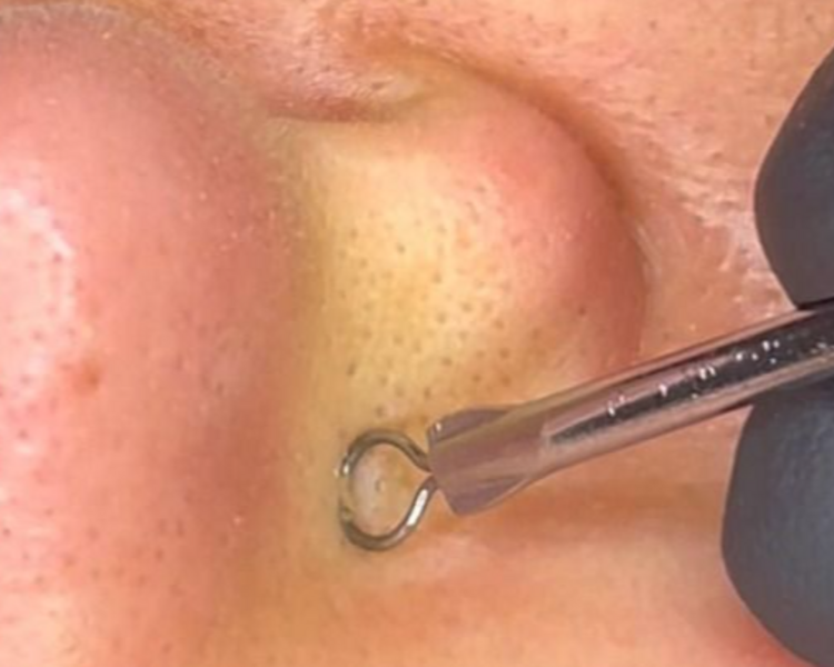 Limpieza con extraccion