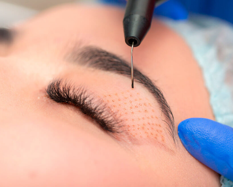 PlasmaPen Facial