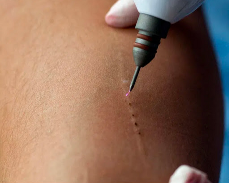 PlasmaPen Corporal
