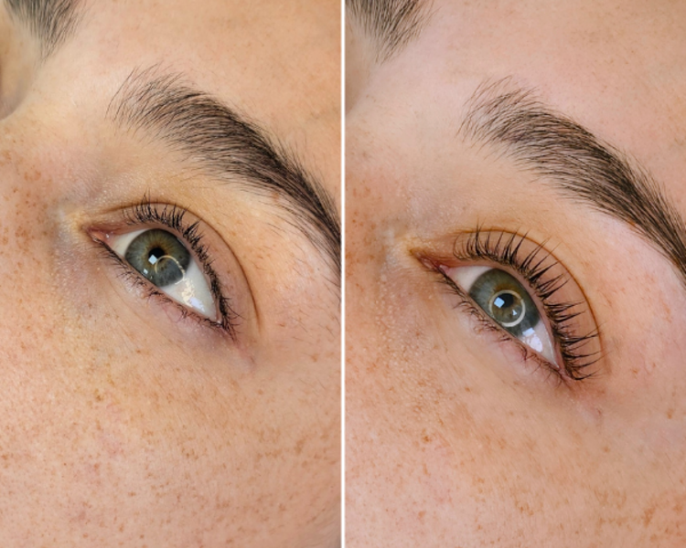 Lash lifting