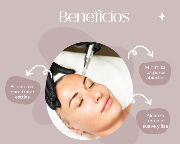 Microneedling rostro