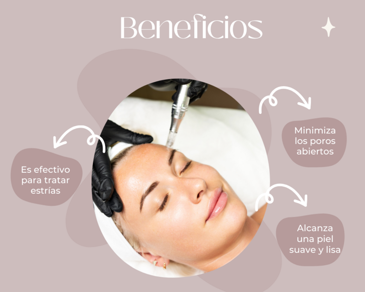 Microneedling rostro y cuello 
