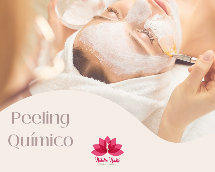 Peeling Quimico